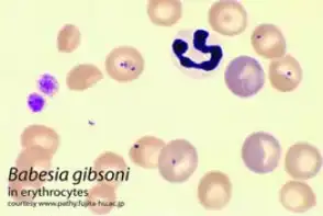 Blood smear of a dog infected with Babesia gibsoni