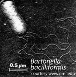 Electron micrograph of Bartonella bacilliformis