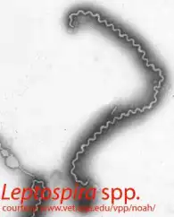 Scanning electron micrograph of Leptospira spp