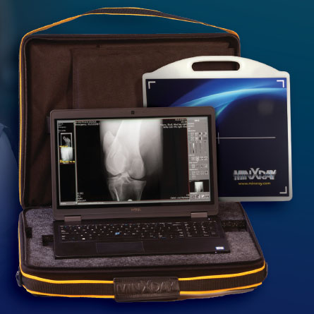 x-ray machine