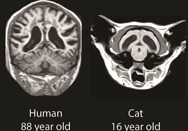 MRI